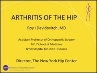 Arthritis of the Hip, New York